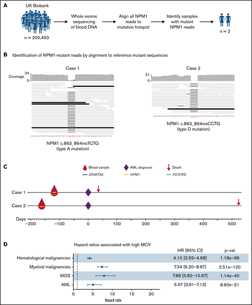 Detection and significance of NPM1 mutations in blood DNA of healthy individuals. (A) Approach used to identify NPM1 gene mutations in WES of blood DNA from 200 453 UKBB participants. (B) Alignment of sequencing reads from the 2 cases with NPM1 mutations against reference type A (left) and type D (right) NPM1 mutations. This identified 4 reads reporting the type A mutations in case 1 (left) and 1 read reporting the type D mutation in case 2 (right). Mutant reads (black horizontal bars) match perfectly with their respective reference mutant sequences, whereas wild-type reads (colorless horizontal bars) align with a 4-nucleotide gap at the insertion/duplication hotspot. (C) Timeline, gene mutations, and outcomes of the 2 individuals with NPM1 mutations. Both cases were also found to harbor mutations in the DNMT3A gene, whilst case 1 also harbored an internal tandem duplication in the FLT3 gene. (D) Forest plot of hazard ratios for hematological malignancies, myeloid malignancies, AML, and MDS associated with a high MCV (MCV > 99.5 fl) in the UKBB. CI, confidence interval; HR, hazard ratio; MCV, mean corpuscular volume; MDS, myelodysplastic syndrome.