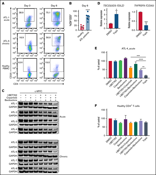 Triple combination inhibits c-MYC in PBMCs containing leukemic cells ex vivo from ATL patients. (A) Expression of CD25 on CD4+T cells of PBMCs isolated from acute ATL (n = 4), smoldering/chronic ATL patients (n = 4), and healthy donors (n = 5). The expression was measured on day 0 (before) and day 6 (after) ex vivo culture. rIL-2 cytokine (100 U/ml) was added into the culture of PBMCs from acute ATL patients and healthy donors. (B) The bar graphs represent average percentages of CD4+CD25+ on T cells of healthy donors (n = 5) and acute and chronic ATL patients (n = 8) after 6-day ex vivo culture. Error bars represent mean ± SEM. Student t test was used to determine statistical differences. ****P < .0001. (C) Western blot analysis of c-MYC after 6-day ex vivo culture treated with 1 μM of I-BET762, copanlisib, and bardoxolone methyl or combination for 2 hours (n = 8). (D) Quantitative real-time PCR analysis of TSCD22D3 (GILZ) and TNFRSF8 (CD30) transcripts in PBMC cultures of patients treated with DMSO or 1 μM of the triple combination for 4 hours (n = 5). (E) Cell viability of the PBMCs from an acute ATL patient and (F) CD4+ T cells isolated from a healthy donor, cultured with I-BET762 (250 nM), copanlisib (125 nM), and bardoxolone methyl (62.5 nM), n = 3. One-way ANOVA or Student t test was used to determine statistical differences. *P < .05, **P < .01, ****P < .0001.