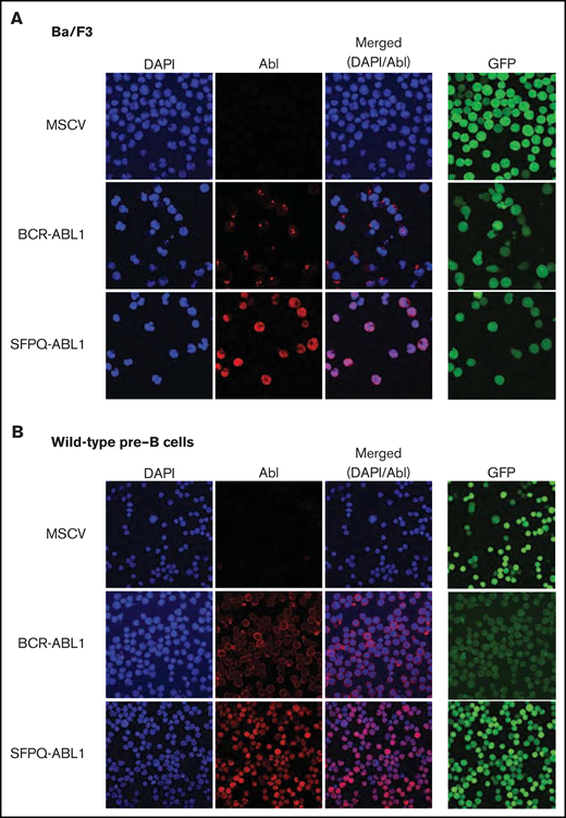 SFPQ-ABL1 localizes to the nucleus. Immunofluorescence analysis of Ba/F3 (A) and wild-type pre-B (B) MSCV (control), BCR-ABL1– or SFPQ-ABL1–expressing cells. Images were captured using ×40 magnification. Slides were viewed by using the Zeiss Elyra 780 confocal microscope and images analyzed using ZEN (black edition). DAPI, 4′,6-diamidino-2-phenylindole; GFP, green fluorescent protein.