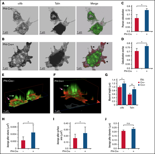 STED super-resolution microscopy 3D imaging of talin and αIIb localization in platelets. (A-J) SHARPINfl/fl Pf4-Cre+ and SHARPINfl/fl Cre− platelets were allowed to spread on fibrinogen-coated coverslips for 30 minutes and then stained with primary antibodies against αIIb and talin and secondary Alexa-594 goat anti-rat and Atto 647N goat anti-mouse antibodies, respectively. Sixteen 0.1-μm sections that spanned the entire platelet were acquired with a Leica SP8 confocal STED microscope with white light laser, equipped with a ×100 STED oil objective. Images were processed using Leica LASX software and Photoshop, with linear adjustments applied similarly. (A-B) Front view of sample platelets from SHARPINfl/fl Pf4-Cre− (A) and SHARPINfl/fl Pf4-Cre+ (B) mice. Arrowheads indicate peripheral regions of αIIb and talin association, pseudocolored green and red, respectively. (C-D) Quantification of αIIb and talin association, as indicated by Pearson’s colocalization (C) and colocalization overlap analyses (D). (E-F) Clipping views of SHARPINfl/fl Pf4-Cre− (E) and SHARPINfl/fl Pf4-Cre+ (F) fibrinogen-adherent platelets showing central apical-dorsal “pillars” of αIIb and talin that traversed the platelet body and appeared as an organized assembly in 3D space. Arrows denote relative maximum heights of αIIb and talin. (G-J) Quantification of apical-dorsal pillars. Platelet αIIb staining was used to set a stringent threshold for pillar discrimination and applied identically to images of SHARPINfl/fl Pf4-Cre− and SHARPINfl/fl Cre+ platelets. (G) Maximal pillar height. **P < .01. (H) Average pillar volume. (I) Average pillar surface area. (J) Average pillar diameter. SHARPINfl/fl Pf4-Cre− platelets showed significantly higher pillar volume and surface area than their wild-type counterparts (H-I), but no difference in column diameter was found (J). Approximately 25 to 40 cells were analyzed for each group. Data represent the sum of 4 individual experiments. n.s., not significant; *P < .05.