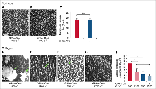 Loss of SHARPIN from platelets results in compromised thrombus formation on collagen under shear flow conditions. A predetermined volume of whole blood (130-200 μL) obtained from SHARPINfl/fl GPIbα-Cre− (A,D,E) and SHARPINfl/fl GPIbα-Cre+ (B,F,G) mice was aspirated through matrix-coated iBidi μSlide VI0.1 flow channels at the indicated shear rates. Adherent platelets were perfusion fixed and stained for αΙΙb, and images were acquired by deconvolution microscopy using a ×20 objective. The average platelet surface coverage was determined with Image Pro software (Media Cybernetics). (A-C) Fibrinogen matrix. n.s., not significant. (A-B) Deconvolved images of SHARPINfl/fl GPIbα-Cre− (A) and SHARPINfl/fl GPIbα-Cre+ attached platelets (B). (C) Average 2-dimensional area per field of view of fluorescent platelets attached to fibrinogen (n = 5). (D-H) Collagen matrix. *P < .05; **P< .01. (D-G) Images of attached platelets and thrombi. Arrows indicate platelet aggregates. (D,F) G = 350 s−1. (E,G) G = 1700 s−1. (H) Six optical sections of 0.2 μm each were acquired, and 3D rendered images of platelets and thrombi were prepared. The average 3D surface area per field of view of fluorescent platelets on collagen was calculated using Image-Pro software (n = 5).