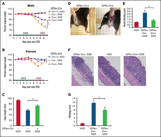 Platelet-specific deletion of SHARPIN ameliorates DSS-induced colitis. (A-G) SHARPINfl/fl GPIbα-Cre mice were provided autoclaved water or DSS, and then all mice were switched to water only, as indicated, and euthanized on day 9. (A-B) Mouse weight loss, represented as a percentage of original weight, for males (A) and females (B) (n = 8, n = 4, respectively) (**P < .01 by 2-way ANOVA analysis) (C) Colon length (n = 12/11, combined male and female mice). (Note: 1 SHARPINfl/fl GPIbα-Cre− mouse died before the end of the experiment, leading to colon autolysis, yielding unequal n.) (D) Rectal bleeding in SHARPINfl/fl GPIbα-Cre+ (left) and SHARPINfl/fl GPIbα-Cre− (right) mice, as indicated by the arrow. (E) Summary of rectal bleeding score (n = 9) (right). (F) Hematoxylin and eosin (H&E) staining of paraffin-embedded SHARPINfl/fl GPIbα-Cre tissue imaged at ×20 from the medial-distal region of the colon, showing extensive inflammation and ulceration in the SHARPINfl/fl GPIbα-Cre− colons. (G) Histology score calculated from H&E-stained colon images (n = 4). *P < .05; **P < .01.