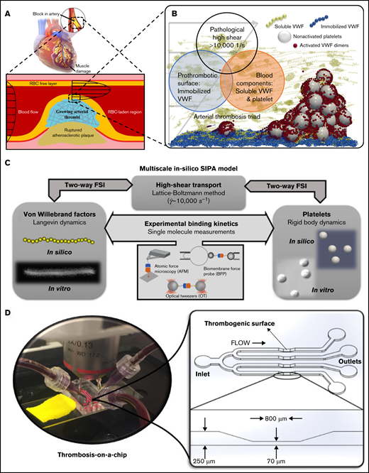 The biological basis, framework, and in vitro tool for the multiscale in silico model of SIPA. (A) Atherosclerosis creates a stenosis with wall shear rate to above 10 000 s−1, leading to an acute arterial thrombus if the plaque cap ruptures. (B) At the exposed collagen surface, SIPA stems from nonactivated platelets and VWF. We virtually construct SIPA in a computational model including immobilized VWF dimers as blue beads on the surface, soluble VWF depicted as yellow strings, and GPIb-A1 bonds as red beads. (C) Framework of the multiscale in silico method.26 VWFs and platelets are modeled in silico to match their biological counterparts based on in vitro measurements.14,16 The dynamics of VWF strands and platelets suspended in the blood subjected to high shear rates are resolved through the coupling among lattice-Boltzmann method, Langevin-dynamics, and rigid body dynamics with fluid-structure interactions (FSI). Platelet and VWF binding kinetics are incorporated to the model, where the kinetic rates can be measured through single-molecular measurements such as biomembrane force probe,50,51 optical tweezers,20,21 atomic force microscopy,52 etc. (D) A low-variability, high-throughput thrombosis-on-a-chip platform12 is used for the validation of the in silico results. Panels C and D partially adopt figures from previous publications14,16,32 with permission.