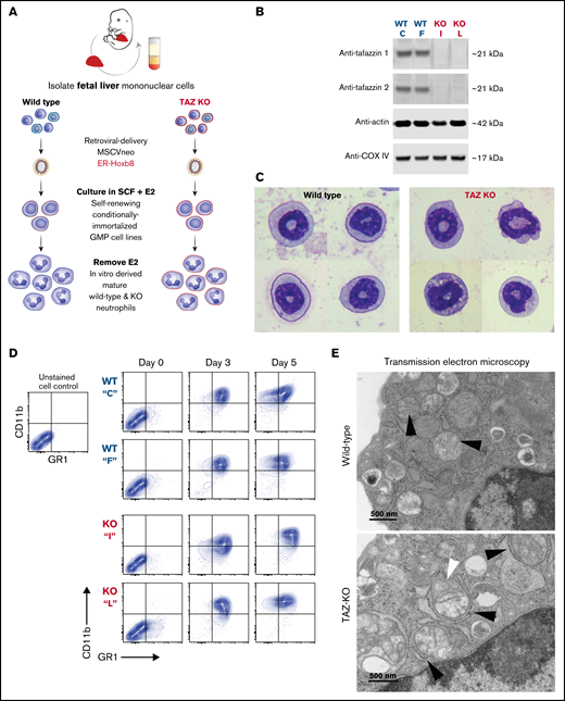Conditionally immortalized GMPs generated from WT and TAFAZZIN-KO fetal liver hematopoietic progenitors. (A) Schematic outlining the generation of conditionally immortalized WT and TAFAZZIN-KO GMPs via the retroviral expression of the ER-Hoxb8 fusion protein, resulting in unlimited ex vivo expansion of progenitors in the presence of estrogen. (B) Immunoblotting confirms the absence of TAFAZZIN expression in the TAFAZZIN-KO GMPs using 2 different antibodies; β-actin and COX-IV are included as housekeeping controls. (C) Wright-Giemsa staining of WT and TAFAZZIN-KO mature neutrophils. (D) Cell-surface staining of CD11b (Mac1) and GR1 (Ly6G/C) was assayed by flow cytometry in the GMPs (day 0) and as the cells differentiated out of estrogen to mature neutrophils (days 3 and 5). There was no apparent difference between WT and TAFAZZIN-KO clones. (E) Transmission electron microscopy of WT and TAFAZZIN-KO GMPs demonstrated more distinct mitochondrial cristae in the WT cells (black arrows, top), with spiral cristae structures more prevalent in the KO (white arrow, bottom). In many cases, the mitochondria within the TAFAZZIN-KO cells were encircled by RER (black arrows, bottom). Scale bar: 500 nm.