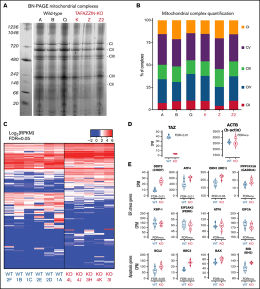 Transcriptomic analysis implicates genes associated with endoplasmic reticulum stress-induced apoptosis. (A) BN-PAGE of purified mitochondrial from three WT ER-Hoxb8 clones and three TAFAZZIN-KO clones. The gel is Coomassie stained. The 5 mitochondrial supercomplexes are highlighted on the right. (B) Following quantification of the mitochondrial supercomplexes, the relative contributions of each supercomplex within each clone depicted. (C) Heat map representation of gene expression from WT (n = 6) and TAFAZZIN-KO (n = 5) GMP clones. (D) TAFAZZIN is the most highly differentially expressed gene. (E) The count per million (CPM) are displayed for select genes involved in mediated ER stress and apoptosis. The false discovery rate (FDR) is displayed with each gene.