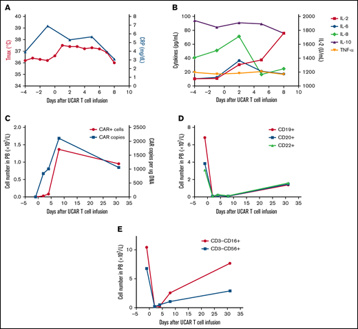 Toxicities, persistence, and response in patient 2 after administration of universal CAR T cells. (A) The change in maximum temperature (Tmax) and the serum level of C-reactive protein (CRP) were monitored in patient 2 before and after universal CAR (UCAR) T-cell infusion, and Tmax and CRP recovered without any treatment. (B) The serum levels of cytokines, including interleukin-2 (IL-2), IL-6, IL-8, IL-10, and tumor necrosis factor-α (TNF-α), were tested before and after UCAR T-cell infusion. (C) Persistence of the infused UCAR T cells in peripheral blood (PB) of patient 2 before and after cell infusion. Flow cytometry and quantitative polymerase chain reaction were used to detect the level of UCAR T cells in PB. (D) The change in B-cell number before and after UCAR T-cell infusion. (E) The change in NK cell number before and after UCAR T-cell infusion.
