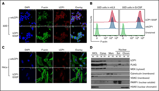 Effect of LCP1 I232F overexpression on actin polymerization. (A) 32D cells expressing LCP1 I232F with dysplastic features were dual fluorescently labeled with anti-LCP1 antibody (red color) and an F-actin probe, phalloidin (green color). The labeled cells were imaged by confocal microscopy. The mutant-expressing cells exhibit increased level of F-actin and enrichment of F-actin and LCP1 at the cell cortex. (B) Flow cytometric quantification of F-actin levels in 32D cells expressing either wtLCP1 or I232F mutant grown under indicated conditions. (C) HeLa cells expressing either wtLCP1 or I232F mutant were imaged by confocal microscopy after dual labeling with anti-LCP1 antibody and phalloidin. (D) Subcellular fractionation of 32D cells expressing LCP1 (wt and I232F) upon 3 days of IL-3 treatment. DAPI, 4′,6-diamidino-2-phenylindole; H2AX, H2A histone family member X; MEK, mitogen activated protein kinase kinase; PARP1, poly (ADP-ribose) polymerase 1; VDAC, voltage-dependent anion channel.