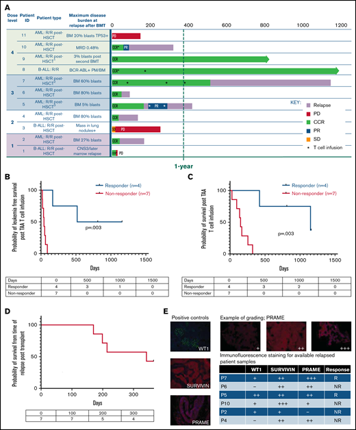 Clinical outcomes for patients treated with TAA-T for relapsed disease after BMT (n = 11). (A) Swimmer plot showing clinical outcomes following salvage therapy and TAA-T infusion in patients with relapsed/refractory disease after BMT, categorized by dose level (1-4). Hematologic remission was achieved in 9/11 patients prior to TAA-T infusion with postinfusion clinical outcomes defined as CCR, PR, stable disease (SD), PD, and relapse. Patients in hematologic remission with MRD are noted as CCR*. Patients who did not achieve hematologic remission are noted as + (P3, P11). The dotted line denotes 1 year postinfusion. (B) Kaplan-Meier curve estimating LFS postinfusion of relapsed patients. One-year LFS 27.3%; median LFS was 64 days. Patients characterized as responders (CCR within 3 months of first TAA-T infusion; n = 4) had prolonged median LFS (839 days) compared with nonresponders (PD/R within 3 months of first TAA-T infusion; n = 7); median LFS was 42 days (P = .003). (C) Kaplan-Meier curve estimating OS postinfusion of relapsed patients. One-year OS was 36.36% with median survival of 255 days post–TAA-T infusion. Responders had prolonged median OS (1150 days) compared with nonresponders (150 days) (P = .003). (D) One-year postrelapse OS was 42% in early relapsers (patients with relapse within 6 months of transplant; n = 7) who received TAA-T infusion. (E) Qualitative grading of immunofluorescence expression of TAA targets (WT1, PRAME, and survivin) on blast population and clinical outcomes following TAA-T of evaluable patients with relapsed AML posttransplant. The paraffin-embedded tissues were deparaffinized and incubated post–antigen retrieval with anti-survivin, anti–Wilms tumor protein (abcam), and anti-PRAME (Sigma) followed by Alexa Fluor568 (Texas red channel) donkey anti-rabbit IgG secondary antibody for survivin and PRAME (abcam) and AlexaFluor488 (FITC) donkey anti-mouse IgG secondary antibody for WT1 (abcam). The sections were mounted with DAPI staining solution (abcam), and the images were captured at 20× magnification on an Olympus BX53-DP73 microscope using cellSens software. Clinical outcomes characterized as responder and nonresponder (as above). (F) Disease course and TCR unique clonotype frequencies over time for P5 with MDS/AML, relapsed 117 days posttransplant and subsequently achieved CR with salvage therapy (azacitidine) prior to TAA-T infusion. Hematologic relapse with peripheral blasts cleared with a second TAA-T infusion, azacitidine, and lenalidomide, though remained MRD+. (G) Disease course and unique TCR clonotype frequency over time for P8, a pediatric patient with Ph+ B-cell ALL with persistent BCR/ABL positivity posttransplant despite treatment with dasatinib. Briefly achieved BCR/ABL negativity following first TAA-T infusion followed by rise in BCR/ABL quantification ratio following the second TAA-T infusion. DAPI, 4′,6-diamidino-2-phenylindole; IgG, immunoglobulin G.