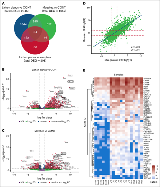 Transcriptomic signature of LP and morphea cGVHD skin lesions. (A) Venn diagram showing the overlap between DEGs in lesional skin of cGVHD as compared with healthy controls (CONT). LP vs CONT in blue, morphea vs CONT in green, and LP vs morphea in red. (B-C) Volcano plot with log2FC and −log10 P values for the DEGs between LP (n = 8) (B) and morphea (n = 5) (C) cGVHD skin lesions vs CONT (n = 6). The most upregulated genes are toward the right, the most downregulated genes are toward the left, and the most statistically significant genes are toward the top. Genes of interest are encircled. (D) Scatterplot of the expression FCs of DEGs in lesional cGVHD. (E) Heatmap of the 50 most upregulated DEGs shared between LP and morphea, defined by contrasting lesional skin of cGVHD and CONT. Levels of expression for most of the DEGs differed in the 2 pathologies. Data are presented as log2 transcripts per million (TPM) expression value. Expression values are depicted according to the color scale. TPM values were estimated for each experimental dataset. A pseudo-count of 0.001 was added to each transcript before log2 transformation. Annotations are colored based on the TPM property, ranging from blue for 0, through to white for the mean TPM, up to red for the highest TPM for any gene in the sample.
