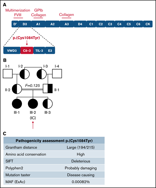 Inheritance and pathogenicity of novel VWF variant p.(Cys1084Tyr). (A) Schematic representation of the VWF domain structure with subdomain architecture and critical functional sites. The location of the p.(Cys1084Tyr) variant in the C8-3 subdomain is shown. (B) Three-generation pedigree of a consanguineous family diagnosed with VWD. Homozygous individuals are represented by black symbols and heterozygous individuals by half-filled symbols. (C) Pathogenicity prediction for VWF variant p.(Cys1084Tyr).