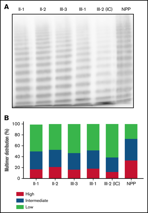 Phenotypic characterization of family members. (A) Multimer distribution of plasma VWF in heterozygous and homozygous family members relative to normal pooled plasma (NPP). Heterozygous and, to a greater degree, homozygous family members show a relative reduction in high molecular weight multimers. (B) Multimer analysis was performed using 1-dimensional densitometry and the relative percentage of high-, intermediate-, and low-molecular-weight multimers was reported. The greatest reduction in high-molecular-weight material was observed in the IC.