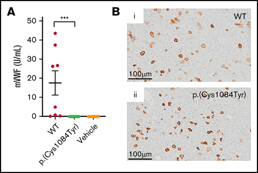 Hepatic expression of p.(Cys1084Tyr) abolishes VWF secretion in VWF−/− mice. (A) Following hydrodynamic gene transfer of the cysteine variant mouse Vwf cDNA, no p.(Cys1084Tyr) VWF was detectable in the plasma of VWF−/− mice. Data represent mean ± SEM, ***P < .001. (B) DAB peroxidase staining of formalin-fixed paraffin-embedded mouse liver sections showed equivalent intracellular expression of both WT-VWF and p.(Cys1084Tyr) VWF in ∼5% of hepatocytes.