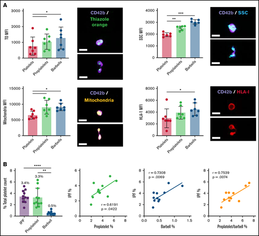 Quantification of RPs, preplatelets, and barbells in human whole blood. Healthy control trisodium citrate–anticoagulated whole blood was labeled immediately after phlebotomy with anti-CD42b BV421 and TO, Mitotracker AF599, or anti-HLA-I APC (n = 5; bar represents 7 μm), and granularity was determined by SCC light. (A) Representative images of preplatelets and barbells with each label are shown. Mean fluorescence intensity (MFI) was normalized to the cellular perimeter. (B) Under the same conditions, citrate blood was labeled with anti-CD61 FITC and CD62p BV421 for 15 minutes at 37°C, %IPF platelets was measured by Sysmex XN1000, and preplatelets and barbells were quantified by ISFC and correlated with IPF (n = 12). (A-B) One-way analysis of variance with Dunnett’s multiple-comparisons test ±1 standard deviation; (B) Pearson’s correlation coefficient. *P < .05; **P < .01; ***P < .001; ****P < .0001.