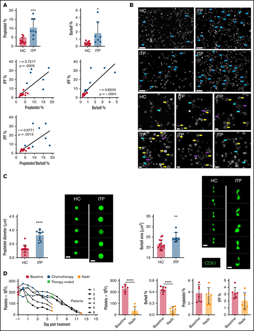 Quantifying reticulated platelets, preplatelets, and barbells in acquired thrombocytopenia. All measurements were performed in trisodium citrate–anticoagulated whole blood. (A) Healthy control (HC; green dots; n = 12) and ITP (red dots; n = 7) blood was incubated at 37°C for 1.5 hours; platelet count, MPV, and IPF were measured by the XN1000 hematology analyzer (Sysmex); and preplatelets and barbells were measured by ISFC with correlations between IPF% and preplatelets and/or barbells. (B) α-Tubulin immunofluorescence imaging of control and ITP platelet-rich plasma displaying preplatelets (yellow arrows), barbells (blue arrows), and elongated preplatelets (purple arrows; n = 3; Leica DM6000 wide-field microscope, ×60 magnification; bars represent 5 μm). (C) Mean diameter of preplatelets and area of barbell platelets measured by ISFC in healthy control blood (n = 15) vs ITP blood (n = 8; bar represents 7 μm). (D) Blood samples were taken from patients with high-grade lymphoma or myeloma before chemotherapy (baseline; day −1), 5-7 days after stem cell autograft (nadir). Platelet counts and IPF were measured by the XN1000 analyzer and preplatelets and barbells by ISFC (n = 6). (A-B,D) Unpaired t-test ±1 standard deviation. (A) Pearson’s correlation coefficient. *P < .05, **P < .01, ***P < .001; ****P < .0001.