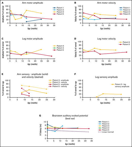 Nerve conduction studies and BAER results over time. Infants underwent nerve conduction studies before and after HCT. Motor neuropathy is present and progressive in most infants in the upper (A-B) and lower (C-D) extremities. Similarly, sensory neuropathies are present and progressive (E-F). BAER study results were abnormal in all patients tested over time (G).