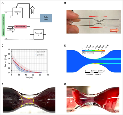 In vitro flow loop for generating a SIPA clot. (A) A constant-pressure closed loop circuit with a roller pump was developed to generate a clot in (B) a collagen-coated glass stenosis that has a throat diameter of ∼2.5 mm. A total volume of 400 mL of blood was circulated through the flow loop. (C) To maintain a constant 30-mm Hg pressure head, the roller pump flow rate was reduced as the clot grew over time (red, mean of 8 with standard deviation, shown by vertical lines) as compared with the simulated flow rate in an empirical model of SIPA thrombus growth rate (blue, upper and lower limit displayed in the bars). (D) The initial maximum shear rate in the throat was greater than 10 000 s−1. The area of high shear is consistent with the thrombus location in the stenosis. (E) The SIPA clot occluded the stenosis with a trumpet-like shape. The boundary of the SIPA clot is highlighted by the yellow dotted line. (F) The glass tube with the SIPA clot after blood was drained, showing the extension of the thrombus at the wall both upstream and downstream of the throat.