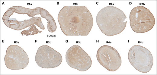 VWF immunostaining of the SIPA clot in the transverse direction. Starting from the upstream, each section is spaced ∼0.5 mm apart. Sequential sections corresponding to the regions of interest indicated in Figure 2B (R1a-R4b).