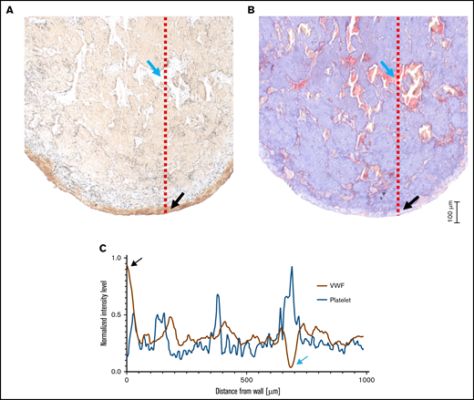 Comparison of VWF and platelet density near the channel wall. VWF staining (A) and Carstairs staining (B) of a SIPA clot in the transverse direction (original magnification, ×10). (C) Normalized intensity level along the red lines in panels A and B. Near the lumen wall, VWF was concentrated and dark, yielding low-intensity levels; whereas the Carstairs-stained platelet was light at the wall, corresponding to a high-intensity level. Black arrows indicate the starting point close to the wall, and blue arrows indicate a pore in the clot.