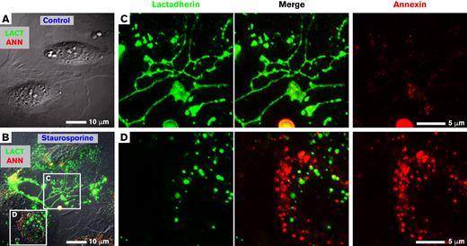 PS-containing features on staurosporine-treated HUVECs bind lactadherin or annexin A5. Staurosporine-treated HUVECs were incubated with 10 nM lactadherin-488 (green) and annexin A5-Cy3 (red) and visualized with live-cell imaging. (A) Representative image of control, vehicle-treated HUVECs with differential interference contrast (gray scale) and fluorescence lactadherin (green) and annexin A5 (red) overlaid. Note the absence of either green or red fluorescence. (B) HUVECs pretreated for 15 minutes with 0.5 μM staurosporine before incubation with lactadherin and annexin A5. The representative image shows strong binding of lactadherin and annexin A5 to submicrometer scale structures with filopodialike (C) and punctate (D) structures. (C-D) Enlarged views of boxed regions in panel B showing individual and merged fluorescence signals.