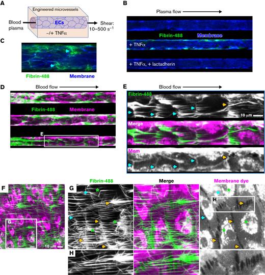 Fibrin deposition around TNF-α–treated endothelial cells under flow conditions. (A) Engineered microvessel setup. HUVECs were grown to confluence on engineered microfluidic substrate and pretreated with TNF-α (100 ng/mL), overnight (B-C) or for 4 hours (D-H). The cell layer was stained with CellMask Orange or Deep Red to visualize the plasma membrane (pseudocolor blue B, C; magenta D-H). Fresh plasma (B, C) was supplemented with corn trypsin inhibitor and fluorescein-labeled fibrinogen (green) and passed through the microfluidic with a sheer of 500 seconds−1 for 30 minutes. The microvessels were imaged with fluorescence microscopy. (B) Representative image of fibrin definition in TNF-α–treated microvessel perfused with plasma at 500 seconds−1. Fibrin deposition was not observed in the control channel and was prevented by lactadherin in TNF-α–treated microvessels. (C) Enlarged view of TNF-α–treated microvessel with arrows identifying fibrin deposition at cell junctions or intercellular gaps. (D) Fibrin deposition was also evaluated after perfusion of fresh whole blood, supplemented with corn trypsin inhibitor and fluorescein-fibrinogen at sheer of 100 seconds−1. Fibrin accumulated at cellular junctions (magenta pseudocolor) in a reticular pattern (magenta) as well as in strands in the direction of flow. (E) Enlarged view of boxed region in panel D with fibrin staining shown as white in the top panel, membrane staining as white in the bottom panel, and merged image in the middle. Arrows highlight junctional deposition of fibrin coincident with intact junctions (cyan) or gaps containing junctions with filament-/filopodia-like structures (yellow). (F) Representative field of view under conditions as in panel D, at higher magnification. (G) Enlarged view of boxed region in F with fibrin shown in white (left) membrane in white (right) and merged (middle). Arrows (G-H) highlight junctional deposition of fibrin coincident with intact junctions (cyan) or gaps containing junctions with filament-/filopodia-like structures (yellow). Asterisks indicate occasional fibrin depositions initiated at discrete locations on the cell body. (H) Further enlargement of the boxed region in panel G.