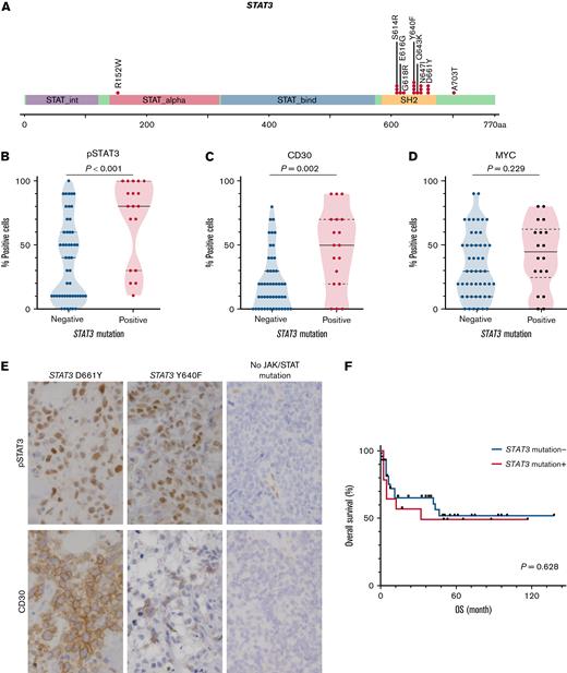 STAT3 mutations in ENKTLs. (A) Mutation distribution. (B-D) Semiquantitative measurements of pSTAT3, CD30, and MYC expression as a function of STAT3 mutation status. (E) Representative IHC images for pSTAT3 and CD30 by STAT3 mutation status. Original magnification ×400. (F) Kaplan-Meier plot of OS as a function of STAT3 mutation status.