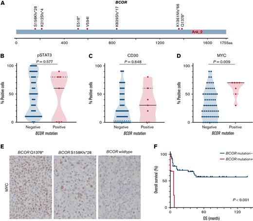 BCOR mutations in ENKTLs. (A) Mutation distribution. (B-D) Semiquantitative measurements of pSTAT3, CD30, and MYC expression as a function of BCOR mutation status. (E) Representative IHC images for MYC by BCOR mutation status. Original magnification ×400. (F) Kaplan-Meier plot of OS as a function of BCOR mutation status.