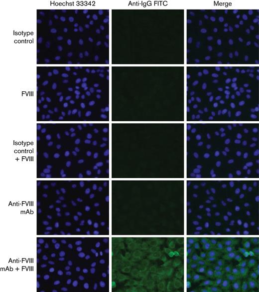HEp-2 immunofluorescent staining of control antibodies. Anti-FVIII monoclonal mAb, isotype controls or human recombinant FVIII alone do not bind to HEp-2 cells, whereas immune complexes of anti-FVIII mAb plus FVIII produce a cytoplasmic reticular staining pattern like that observed in 6 patients with AHA (bottom row, compare Figure 1D).