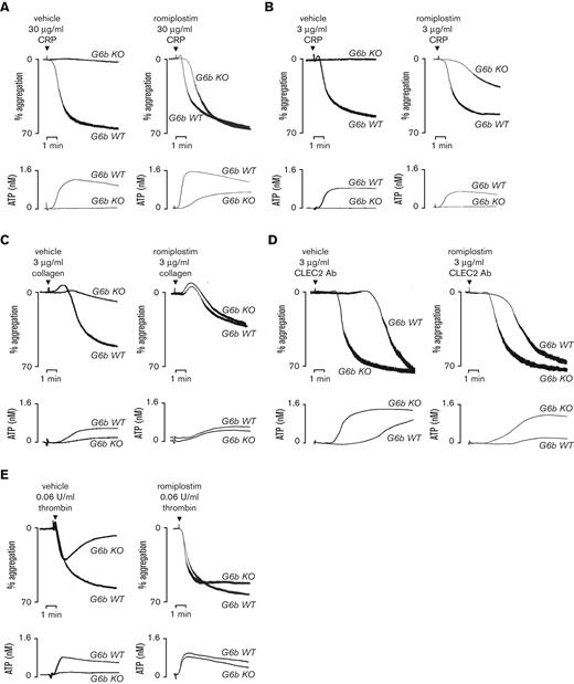 Romiplostim rescues platelet reactivity in G6b-deficient mice. Washed platelet aggregation and ATP secretion of WT and G6b KO mice before and after 21 days after romiplostim administration were measured using lumi-aggregometry in response to (A-B) 30 and 3 μg/mL collagen-related peptide (CRP), (C) 3 μg/mL collagen, (D) 3 μg/mL CLEC2 Ab and (E) 0.06 U/mL thrombin. Following romiplostim administration, platelets from G6b KO mice aggregated normally in response to 30 μg/mL CRP and 3 μg/mL collagen, compared with treated WT mice (A,C) and an increased response to 3 μg/mL CRP was observed in treated vs untreated G6b KO mouse platelets (B). Romiplostim treatment also partially attenuates the response of WT and G6b KO platelets to anti-CLEC-2 antibody (D) and fully restores reversible aggregation and reduced ATP secretion in response to 0.06 U/mL thrombin in G6b KO mice (E). Representative traces are shown, n = 5 to 8 mice per genotype per condition.