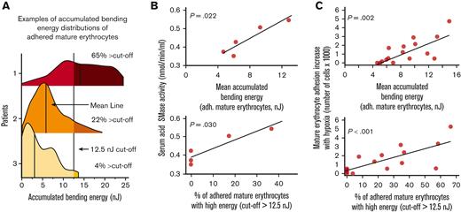 Greater accumulated bending energy is associated with higher acid SMase activity and increased mature erythrocyte adhesion. (A) Accumulated bending energy distributions of mature erythrocytes under hypoxia vary widely between patients. Three example distributions are shown, with varying distributions for the demonstration. Distributions are represented by 2 parameters for statistical analysis: mean accumulated bending energy and percent cells above 12.5 nJ cutoff. (B) Accumulated bending energy distribution parameters associated with serum acid SMase activity of patients with SCD that are not recently been transfused (P = .022, for mean accumulated bending energy, and P = .030 for percent cells above 12.5 nJ cutoff, N = 5). (C) An increase in mature erythrocyte adhesion with hypoxia is associated with mean accumulated bending energy (P = .002, N = 16) and the percentage of adhered mature erythrocytes with relatively higher accumulated bending energy (P < .001, N = 16). P values are calculated using linear regression.