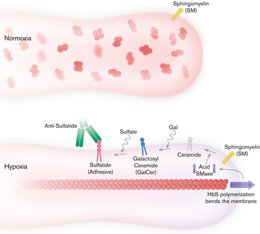 Proposed mechanism for blocking mechanical bending-associated mature erythrocyte adhesion. Low-level adhesion and high deformability of mature erythrocytes are favorable for SCD. HbS does not disrupt SMase activity under normoxia. However, under hypoxia, HbS polymerization increases the accumulation of bending energy and initiates a cascade that leads to sulfatide exposure via SMase upregulation. Therefore, mature erythrocytes become highly adhesive, suggesting poor biophysical properties. Inhibition of mature erythrocyte adhesion is possible with antibodies against sulfatide; however, inhibition of SMase activity could also improve other biophysical properties of mature erythrocytes, such as deformability, while preventing abnormal adhesion as well.