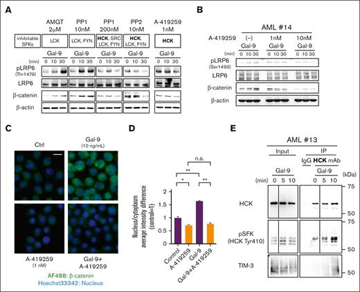 HCK is a critical signal transducing molecule involved in TIM-3–induced canonical Wnt pathway activation. (A) WB analysis of Gal-9–stimulated KASUMI-6 cells in the presence of SFK inhibitors: AMGT, PP1, PP2, and A-419259 (potent HCK inhibitor). Inhibitable members of SFKs at each concentration of inhibitors are listed. Because KASUMI-6 cells showed obvious response to SFKs inhibitors, we presented the representative data of KASUMI-6 cells. (B) WB analysis of cell lysates from Gal-9–stimulated TIM-3+ primary samples in the presence of 0, 1, and 10 nM of A-419259. Cells were preincubated with A-419259 for 2 hours before stimulation with Gal-9. Representative results out of 4 independent TIM-3+ AML cases (AML#6, #9, #14, and #17) are shown. (C) Images of KASUMI-3 cells captured from representative fields obtained by ArrayScan analysis. These cells were stimulated with or without Gal-9 in the presence or absence of A-419259 for 20 hours. Scale bar represents 10 μm. (D) Extent of β-catenin translocation to the nucleus evaluated using the ArrayScan system compared with nonstimulated control. Data are presented as mean ± SEM, ∗P < .05 and ∗∗P < .01. (E) Immunoblotting analysis with HCK, pSFK, and TIM-3 antibodies of total cell lysates (left) and immunoprecipitated lysates (right). Cells were stimulated with Gal-9 for 0, 5, and 10 minutes and subsequently lysed and subjected to IP with an HCK antibody or normal rabbit IgG. Representative results (AML#13) out of 3 independent experiments are shown here.