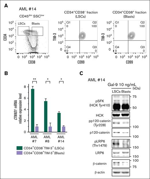 TIM-3 signaling induces β-catenin accumulation in accordance with p120-catenin expression level in AML. (A) FACS analysis of the expression of TIM-3 on CD34+CD38– (middle; LSCs-enriched fraction) and CD34+CD38+ (right; main blasts–enriched fraction) AML cells from the CD45dimSSClow fraction. Representative FACS plots of 4 independent AML samples (AML#7, #8, #13, and #14) are shown. (B) RT-qPCR analysis of the expression of CTNND1 mRNA in LSCs compared with blasts from AML samples of 3 independent AML cases. Results were normalized to the mRNA expression of GAPDH. Data are presented as mean ± SEM, ∗∗P < .01 and ∗P < .05. (C) WB analysis of cell lysate from Gal-9–stimulated CD34+CD38– AML cells (LSCs) and CD34+CD38+ cells (blasts) (AML#14). Of note, LSCs with higher p120-catenin expression exhibited profound β-catenin accumulation.