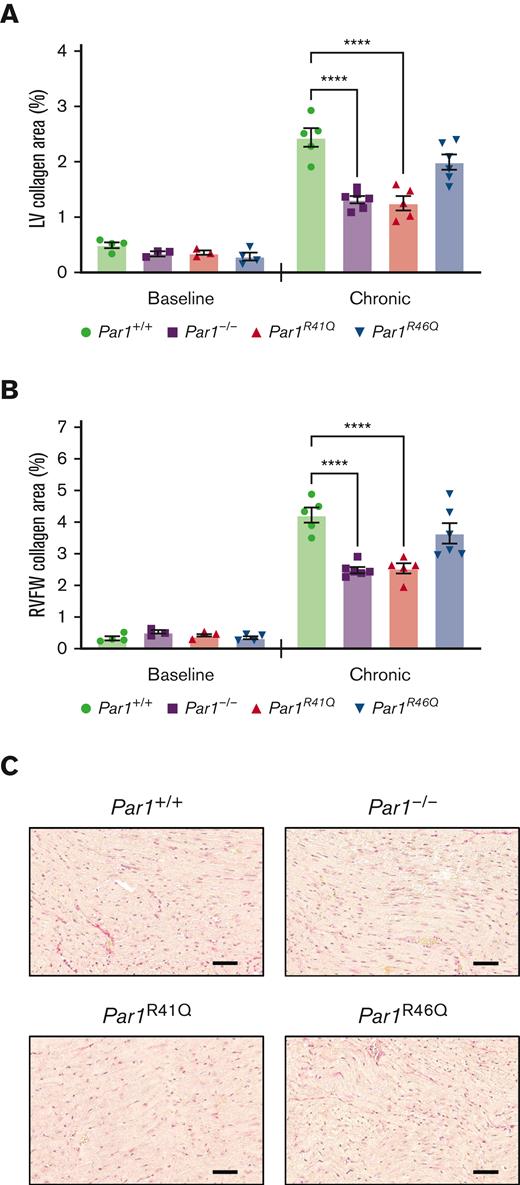 Thrombin insensitive PAR1 transgenic mice demonstrate reduced doxorubicin-induced cardiac fibrosis. Quantification of (A) LV and (B) RVFW, and collagen content from picrosirius red-stained heart sections from Par1+/+, Par1-/-, Par1R41Q, and Par1R46Q mice at baseline and on day 35 in the chronic model of doxorubicin-induced cardiac injury (n = 3-6/group). (C) Representative micrographs of picrosirius red-stained heart sections from Par1+/+, Par1-/-, Par1R41Q, and Par1R46Q mice on day 35 in the chronic model of doxorubicin-induced cardiac injury (Scale bars, 50μm). ∗∗∗∗P < .0001; 2-way ANOVA with post hoc Holm-Sidak tests. Data are represented as individual values with the mean and SEM.
