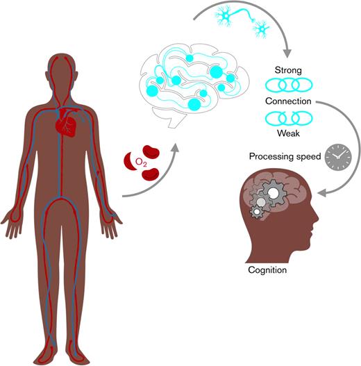 Oxygen saturation, brain white matte connectivity and processing speed in sickle cell disease