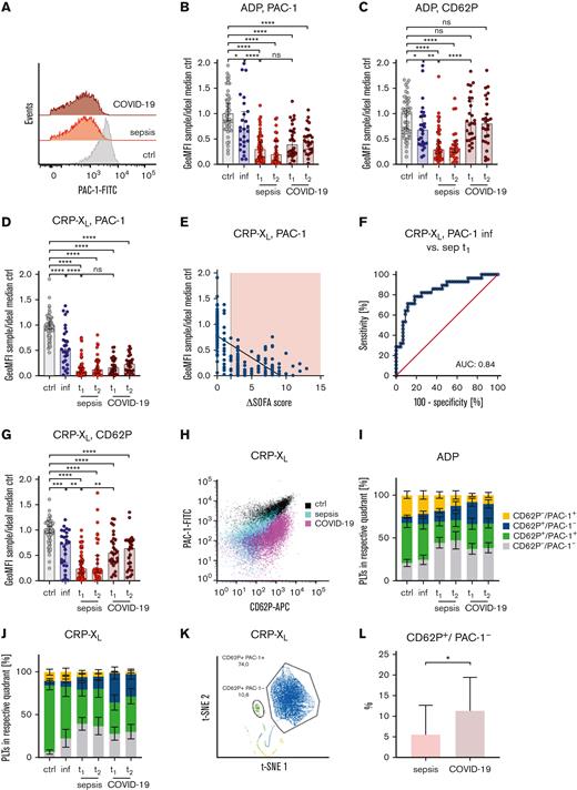 Uncoupled GPIIb/IIIa activation and α-granule release in COVID-19. Characteristics of healthy control participants (ctrl), patients with infection (inf), sepsis, or COVID-19 are displayed on hospital/ICU admission day (t1) and days 4 to 7 (t2). Whole blood was preincubated with ADP (5 μM) (A-C) or CRP-XL (0.01 μg/mL) (D-G) for 5 minutes. Panels A, B, and D-F show GPIIb/IIIa activation, and panels C and G show CD62P exposition measured flow cytometrically. (E) CRP-XL–induced GPIIb/IIIa activation vs SOFA score, red area indicates patients fulfilling Sepsis 3 criteria. (F) Receiver operating characteristic curve analysis of GPIIb/IIIa activation between patients with infection and patients with sepsis at t1 upon CRP-XL stimulation. (H-J) Quadrant analysis of CD62P− and PAC-1+ events upon ADP (I) or CRP-XL (J) stimulation. (K-L) Automated clustering analysis of patients with sepsis (n = 9) and patients with COVID-19 (n = 9) upon CRP-XL stimulation. Representative curves are shown in panels A, H, and K. All graphs show median ± IQR except panels I and J that display mean ± 95% CI. Differences were analyzed using the Kruskal-Wallis test (B-J) or Kolmogorov-Smirnov test (L). ∗P < .05, ∗∗P < .01, ∗∗∗P < .001, ∗∗∗∗P < .0001. AUC, area under the curve; CRP-XL, collagen-related peptide cross-linked.