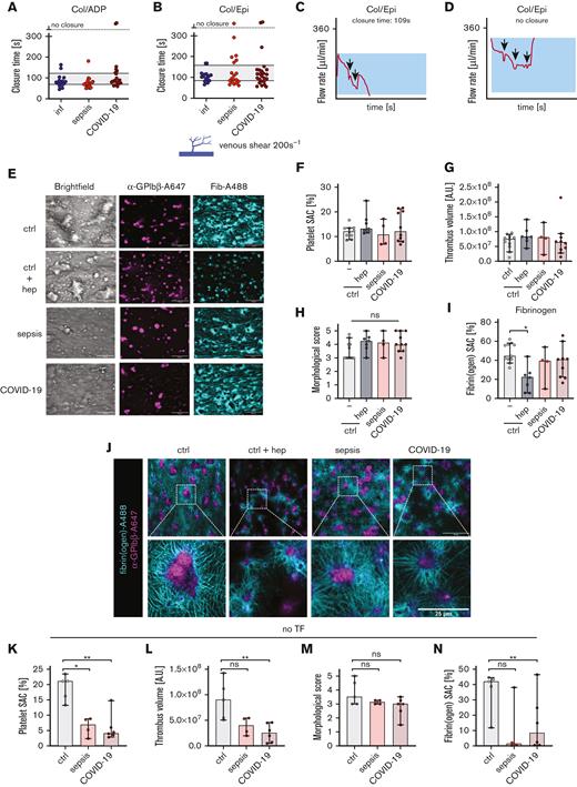 Unaltered in vitro bleeding time in sepsis or COVID-19. (A-D) In vitro bleeding time was mimicked using PFA-200 in whole blood (minimal platelet count > 150/nL). Representative figures are displayed in panels C and D. Arrows indicate sawtooth pattern–like events. Reference ranges are highlighted in panels A and B. (E-N) Thrombus and fibrin formation were assessed under venous shear (200 s−1) using recalcified whole blood on collagen/tissue factor (TF) (E-J) or collagen-coated spots (K-N). Samples were stained for platelets (α-GPIbβ-Alexa647, magenta) and fibrin(ogen) (cyan). Panels F and K show surface area coverage (SAC, %) of platelets, panels G and L show platelet fluorescence intensity in arbitrary units (AUs), panels H and M show the morphological score evaluated by 2 blinded investigators, and in panels I and N, fibrin(ogen) SAC are displayed. Representative images from 1 focal plane are depicted in panel E. Scale bars indicate 50 μm. In panel J, thrombi were imaged in 1 focal plane using confocal microscopy. Scale bar in upper images indicates 50 μm and lower images indicates 25 μm. All graphs show median ± 95% CI. Differences were analyzed using the Kruskal-Wallis test. Col/ADP, collagen/ADP; Col/Epi, collagen/epinephrine; hep, heparin.