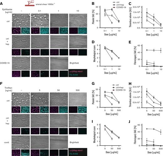 Low-dose GPIIb/IIIa blockade reduces thrombus formation in patients with COVID-19. Characteristics of control participants (ctrl) (n = 9), in vitro–heparinized control samples (n = 8), and patients with COVID-19 (n = 10) are displayed. Thrombus and fibrin formation on collagen/TF spots were assessed under arterial shear (1000 s−1) in recalcified whole blood after preincubation with eptifibatide (A-E) or tirofiban (F-J). Platelets are displayed in magenta and fibrin(ogen) in cyan. SAC (%) of platelets (B and G), platelet fluorescence intensity in AUs (C and H), morphological score depicted by 2 blinded investigators (D and I), and fibrin(ogen) SAC (E and J) are displayed. Representative images from 1 focal plane are depicted in panels A and F; scale bars indicate 50 μm. All graphs show mean ± standard error of the mean. Differences were analyzed using the Kruskal-Wallis test. ∗P < .05, ∗∗P < .01, ∗∗∗P < .001, ∗∗∗∗P < .0001.