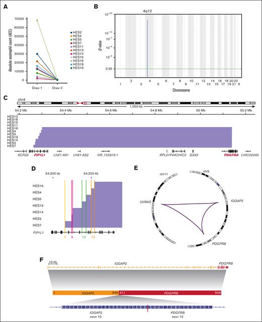 Genomic characterization of PDGFR rearrangements. (A) Absolute eosinophil count before (tumor) and after treatment (normal) with imatinib. (B) GISTIC2 plot depicting the significantly recurrent interstitial deletion on chromosome 4. (C) Genomic view of the F/P locus showing detected deletions (blue bars) in most samples. (D) Detailed view of the breakpoints inside the FIP1L1 gene. Colored lines show location inside introns labeled with matching intron numbers (based on transcript NM_001134937.1). (E) Circos plot11 of the complex PDGFRB rearrangement in patient HES11. Purple lines indicate genomic fusions between the chromosomal regions. (F) Gene locus and inferred protein fusion between PDGFRB and IQGAP2.