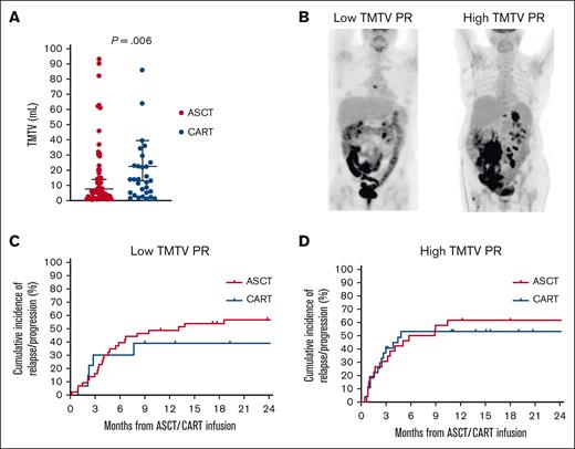 Cumulative incidence of relapse/progression according to TMTV. (A) Distribution of the TMTV in patients who underwent ASCT or CART. (B) Example of low and high TMTV PR. (C) Cumulative incidence of relapse/progression in patients with a low TMTV PR. (D) Cumulative incidence of relapse/progression in patients with a high TMTV PR.
