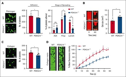 PDK2/4−/− platelets exhibit reduced outside-in signaling and in vitro thrombus formation. (A) WT or PDK2/4−/− washed platelets (2 × 107 cells/mL) stained using Alexa-Fluor 488-conjugated phalloidin were stimulated with PAR4 peptide (70 μM) for 10 minutes and added onto fibrinogen-coated (100 μg/mL) coverslips for 120 minutes. Five images were captured of each sample at random locations. A representative image of platelet adhesion and spreading is shown. Spreading platelets were divided into 3 classes: adhered (Adh) but not spread, filopodia (Filop): spreading platelets and lamellipodia (Lamelli): fully spread. Results are expressed as a percentage of the total number of platelets adhered. Cumulative data of the number of platelets adhered in each sample is shown. Values are mean ± SEM, n = 4 mice per group. Statistical analysis: Mann-Whitney U test (adhesion) or 2-way ANOVA (stage of spreading) followed by Sidak multiple comparisons test; ∗P < .05 and ∗∗P < .01. (B) Clot retraction was measured for 90 minutes in PRP, supplemented with red blood cells, after adding 1 U/mL of thrombin. The left panel shows the representative images at 90 minutes, and the right panel shows the quantification of the clot size. Values are mean ± SEM, n = 5 mice per group. Statistical analysis: Mann-Whitney U test; ∗P < .05. (C) WT or PDK2−/− washed platelets (2 × 107 cells/mL) stained using Alexa-Fluor 488-conjugated phalloidin were added onto collagen-coated (100 μg/mL) coverslips for 45 minutes. Five images were captured of each sample at random locations. A representative image of platelet adhesion is shown. Cumulative data of the number of platelets adhered in each sample is shown. Values are mean ± SEM, n = 5 mice per group. Statistical analysis: Mann-Whitney U test; ∗P < .05. (D) DiOC6-loaded whole blood from WT or PDK2/4−/− mouse was perfused over a collagen-coated (100 μg/mL) matrix for 60 seconds at an arterial shear rate in a BioFlux Microfluidic flow chamber system. The left panel shows the representative image at the end of the assay, and the right panel shows the thrombus growth on the collagen matrix over time. Values are mean ± SEM, n = 3 mice per group. Statistical analysis: 2-way ANOVA followed by Sidak multiple comparisons test; ∗P < .05.