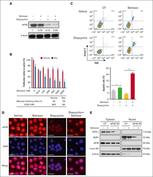 eIF4E KD and selinexor synergistically inhibit MM cell proliferation. Dox-inducible eIF4E KD U266 cells were treated with selinexor (200 nM, unless otherwise indicated) and/or dox (500 ng/mL) for 72 hours. (A) The protein expression of eIF4E level was detected using WB with β-actin as a loading control. The densities of the bands were measured using NIH ImageJ and normalized for β-actin. The immunoblot is representative of 3 independent experiments. (B) Cell proliferation was assessed and the combination of doxycycline and selinexor was compared with selinexor alone. ∗P < .05. Quantification of the maximal inhibitory effects of selinexor is shown underneath the bar graph. (C) Example dot plots (top) and quantification of replicates (bottom) for cell apoptosis were detected via flow cytometry. (D) Immunofluorescence microscopy for eIF4E (red) and with 4′,6-diamidino-2-phenylindole for nuclear counterstaining (blue). Scale bar, 20 μM. (E) Cytoplasmic and nuclear fractions were extracted and analyzed using WB using antibodies against XPO1, eIF4E, IKZF1, and c-MYC. LaminB1 and β-actin were blotted as the markers for nuclear and cytoplasmic fractions, respectively.