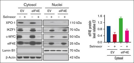 The effects of selinexor on the nuclear export of critical proteins. EV- or eIF4E-overexpressing H929 cells were treated without or with selinexor. Cytoplasmic and nuclear fractions were extracted followed by WB using antibodies against XPO1, eIF4E, IKZF1, and c-MYC. LaminB1 and β-actin were blotted as the markers for nuclear and cytoplasmic fractions, respectively. (Right) Band density analysis of eIF4E in cytoplasmic fractions. eIF4E protein levels were quantified using NIH ImageJ. Values represent the mean ± SEM for 2 independent experiments.