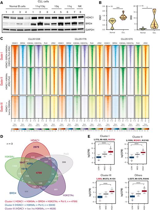 The functional chromatin landscape of CLL as defined by HDAC1 recruitment. (A) Comparison of HDAC1 and BRD4 levels in whole cell lysates of CLL (n = 8; CLL 1-8 = CLL251228, CLL250401, CLL251776, CLL250063, CLL250112, CLL250383, CLL250384, CLL250746) and independent healthy CD19+ selected B cells (n = 4). Cell lysates were sequentially probed for HDAC1, BRD4, and GAPDH on the same immunoblot. (B) Quantitation of HDAC1 and BRD4 in CLL (n = 16, CLL251228(U, 11q-/13q-), CLL250401(U, 11q-/13q-/17p-), CLL251776(Un, 11q-/13q-/17p-), CLL250063(Un, 13q-), CLL250112(Un, NK), CLL250383(Un, 11q-), CLL250384(U, 11q-), CLL250746(Un, NK), CLL251124(U, 13q-), CLL250776, CLL251275(U, 11q-/13q-), CLL250028 (M, 11q-/13q-), CLL250109(M, 13q-), CLL250146(M, 13q-), CLL250943(U, NK), CLL251456(M, NK)) and healthy CD19+ B-cell samples (n = 8). Expression of HDAC1 and BRD4 in healthy B cells and CLL cells were normalized to GAPDH (used as a loading control) and the statistical significance derived using Student two-tailed t tests; ∗P < .5, ∗∗∗P < .001, Graph pad software. (C) ChIP-seq densities ranked in decreasing order for the genome-wide combined occupancy signals of HDAC1 with BRD4, H3K9Ac, H3K27Ac, open ATAC signatures, and RNA Pol2 engagement (cluster I), HDAC1 corecruited with H3K9Ac, ATAC, and RNA Pol2 (cluster II), and HDAC alone (cluster III) centered ±5 kb of the TSS window in 3 CLL samples (CLL251288, CLL251766, and CLL251275). (D) Venn diagram showing the intersection of HDAC1 with BRD4, H3K9Ac, H3K27Ac, and RNA Pol2 recruitment common to 3 primary CLL samples; cluster I (HDAC-BRD4-H3K9Ac-H3K27Ac-ATAC-RNA Pol2) comprises 4799 (in red) peaks with robust HDAC-BRD4-H3K9Ac-H3K27Ac-ATAC-RNA Pol2 tag densities close to the TSS of 5122 total genes, of which 4192 were PCG and 123 were microRNA genes, cluster II (HDAC1-H3K9Ac-Pol2) comprises 5909 peaks (in blue) peaks with robust HDAC1-H3K9Ac-ATAC- Pol2 tag densities close to the TSS of total 5676 genes, of which 4934 were PCG and 164 microRNA genes, and cluster III (HDAC-low/no H3K9Ac-no Pol2) comprises 4626 peaks (in purple) with discrete HDAC1 tag densities with low or no H3K9Ac and minimal Pol2 tag densities close to the TSS of 1077 total genes, of which 927 were PCG and 49 were microRNA genes. (E) Transcriptional output of genes within the HDAC1-containing chromatin. Cluster I accounted for 25% of the CLL transcriptome with 2724 high expressors, 1625 medium expressors, and 773 low expressors. Cluster II accounted for 29% of the CLL transcriptome with 2165 high expressors, 2421 medium expressors, and 1090 low expressors. Cluster III accounted for 6% of the CLL transcriptome with 154 high expressors, 373 medium expressors, and 550 low expressors. In addition, there were 646 high expressors, 1270 medium expressors, and 3277 low expressors not marked by any of the regulatory chromatin modifiers in our study. Analysis of variance was used to compare values between high, medium, and low expressers in clusters I to III and in the group with none of the marks evaluated in our study; ∗∗∗∗P < .0001. 11q-, del11q, 13q-, del13q; 17p-, del17p; GAPDH, glyceraldehyde-3-phosphate dehydrogenase; M, IgVH mutated; NK, normal karyotype; U, IgVH unmutated; Un, unknown.