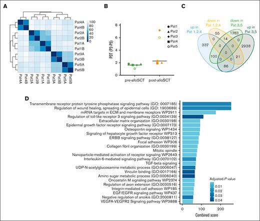 Post-alloSCT derived MSC with reduced proliferation show specific differential expression for genes regulating EMT and ECM. (A) Sample similarity distance matrix of RNAseq analysis from Figure 2 in post-alloSCT MSC of patients 1 to 5 (n = 5 with technical duplicates A/B). (B) PDT (over passage 2-5) in pre- and post-alloSCT MSC from patients 1 to 5. (C) Authentication of DGE in post- vs pre-alloSCT MSC according to their differential proliferation, ie, normal proliferation of post-alloSCT MSC from patients 1, 2, and 4 and reduced proliferation in post-alloSCT MSC from patients 3 and 5. (D) GSEA for upregulated genes in post-alloSCT MSC with damaged proliferation, ie, patient 3 and 5.