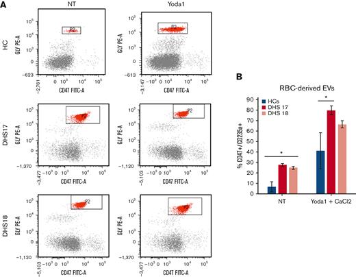 Increased levels of RBC-derived EVs in patients with PIEZO1 GoF mutations. (A) Flow cytometry analysis for RBC-derived EVs. Glycophorin A or CD235a, y-axis, and CD47 (x-axis) (axis values in log scale). Window P2 has CD235a+/Cd47+ cell populations that represent RBC-derived EVs. The analysis was performed in blood samples from HCs and 2 patients with DHS with PIEZO1 mutations (DHS17 and DHS18), not treated or treated with Yoda1 (PIEZO1 activator) and CaCl2. (B) RBC-derived EVs numbers in samples from flow cytometry analysis shown in panel A.