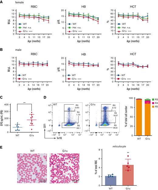 Defect of erythropoiesis in Gata1s adult mice. (A-B) PB indices for WT, Gata1s heterozygous (Het) females, Gata1s homozygous females (F), and Gata1s hemizygous males (M) between 2 and 20 months of age. NWT M ≥ 10, NG1s M ≥ 10, NWT F ≥ 4, NHet F ≥ 7, NG1s F ≥ 5. ∗∗∗P ≤ .001, ∗∗∗∗P ≤ .0001 by 2-way analysis of variance (ANOVA). (C) Erythropoietin (EPO) levels in the PB of 2-month-old animals. Nwt = 7, NG1s = 8. ∗∗P ≤ .01 by the unpaired Student t test. (D) Representative flow cytometry plots and bar graph of mean ± standard deviation (SD for erythroid cells in the PB of Gata1s (G1s) mice as assessed by staining with antibodies against Ter119 and CD71. Nwt = 3, NG1s = 4. (E) Photos (left) and quantitation (right) of reticulocytes in the PB of WT and Gata1s littermates (2 months old). In panel E, scale bars represent 25 μm. The graph depicts the percentage of reticulocytes in 5 fields. N = 5. ∗∗P ≤ .01 by the unpaired Student t test. n.s., not significant.