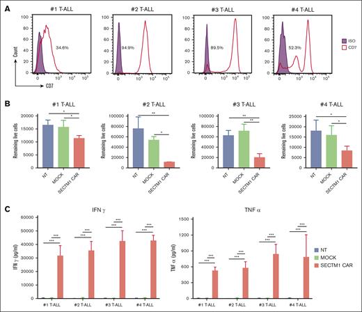 SECTM1 CAR T cells eradicated CD7+ primary T-ALL cells. (A) CD7 expression level of primary leukemic blasts from 4 patients with T-ALL, the percentage of CD7+ cells were showed compared with ISO. (B) The remaining live tumor cells were calculated to detect the cytotoxicity of SECTM1 CAR T cells against T-ALL primary leukemic blasts. (C) IFNγ and TNFα released by the CAR T cells in the experiment described in panel B was detected by ELISA. Left, the IFNγ level; right, the TNFα level. Data in panels B and C are presented as the mean ± SD of triplicates.