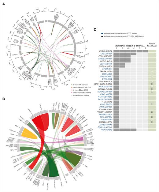 Overview of gene fusions discovered by targeted RNA sequencing. (A) Circos plot showing the gene fusions schematically organized into chromosome position, both for classical and B-other ALL cases. Genes are arranged based on their genomic position in the chromosome (clockwise from chromosome 1 to 22, followed by X and Y). The line links the 2 partner genes in a fusion, and the colored legend shows the rearrangement type. All classical gene fusions are shown as light blue ribbons. (B) Zoomed-in view of fusion genes to show in more detail the rearrangements found specifically in the 144 B-other–classified cases. Ribbon widths are proportional to the frequency of a specific gene in a fusion event. (C) Number of in-frame fusion genes found in 47 of 144 B-other ALL cases. The bars indicate the number of patients in which a given fusion gene was observed. Rare and novel fusion genes discovered in this study are highlighted. §PAX5-ZCCHC7 was found in a patient that also has a functional ETV6-RUNX1 fusion. ∗IGH-CRLF2 were detected by high CRLF2 expression and confirmed by FISH. CTX, interchromosome; DEL, deletion; INS, insertion; ITX, intrachromsome.