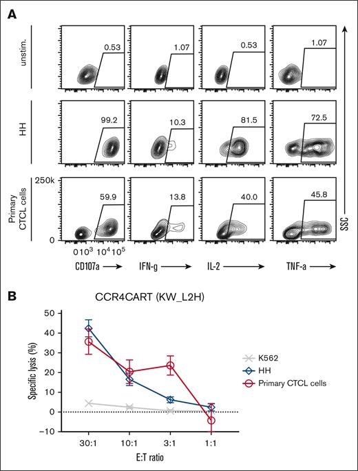 CCR4-CAR T cells can lyse and respond to patient–derived primary CTCL cells. (A) Cytokine production by CCR4-CAR T cells upon stimulation with primary CTCL cells. Cytokine production of CAR T cells at 6 hours after stimulation was analyzed by intracellular staining and FCM. The gates represent a positive population of the indicated cytokines in CAR-positive cells. (B) Lytic activity of CCR4-CAR T cells against primary CTCL cells. The killing activity of CAR T cells against each cell at 4 hours of coculture was analyzed by a 51Cr release assay. Dots and bars represent the mean and standard deviation from a single donor experiment (technical triplicate).