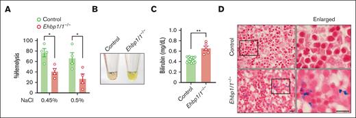 EHBP1L1-deficient erythrocytes are prone to hemolysis. (A) The percentage of hemolysis in enucleated erythrocytes isolated from the peripheral blood of control and Ehbp1l1−/− E18.5 embryos when exposed to the indicated hypotonic solutions is shown (n = 4). The data are representative of 3 independent experiments. (B) A representative picture of serum from control and Ehbp1l1−/− E18.5 embryos is shown. (C) The bilirubin concentration in serum from control (n = 19) and Ehbp1l1−/− (n = 6) E18.5 embryos and P0 mice was determined by using the UnaG protein. (D) Representative images of Berlin blue staining of liver tissues are shown. The areas enclosed in the black squares were enlarged. Scale bars: 10 μm. The data are presented as means ± SEMs for panels A,C. ∗P < .05, ∗∗P < .01 (unpaired t test with Welch’s correction).